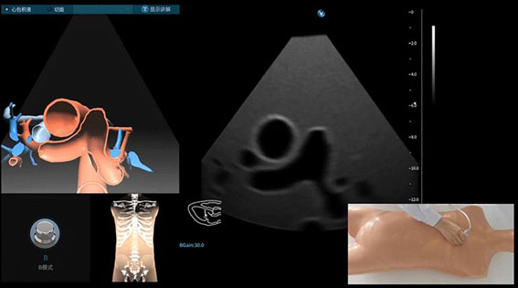 超聲模擬實訓系統 單機版（女）